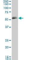 SMAD1 Antibody (clone 2E9)