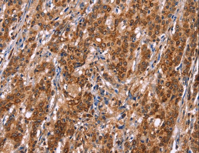Polyclonal Rabbit anti-Human TDP2 / TTRAP Antibody (IHC)