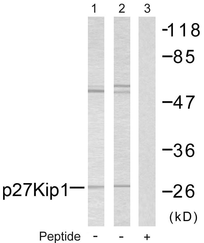 CDKN1B / p27 Kip1 Antibody (p10)