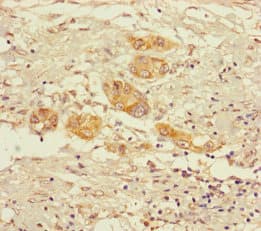 OGDH Antibody