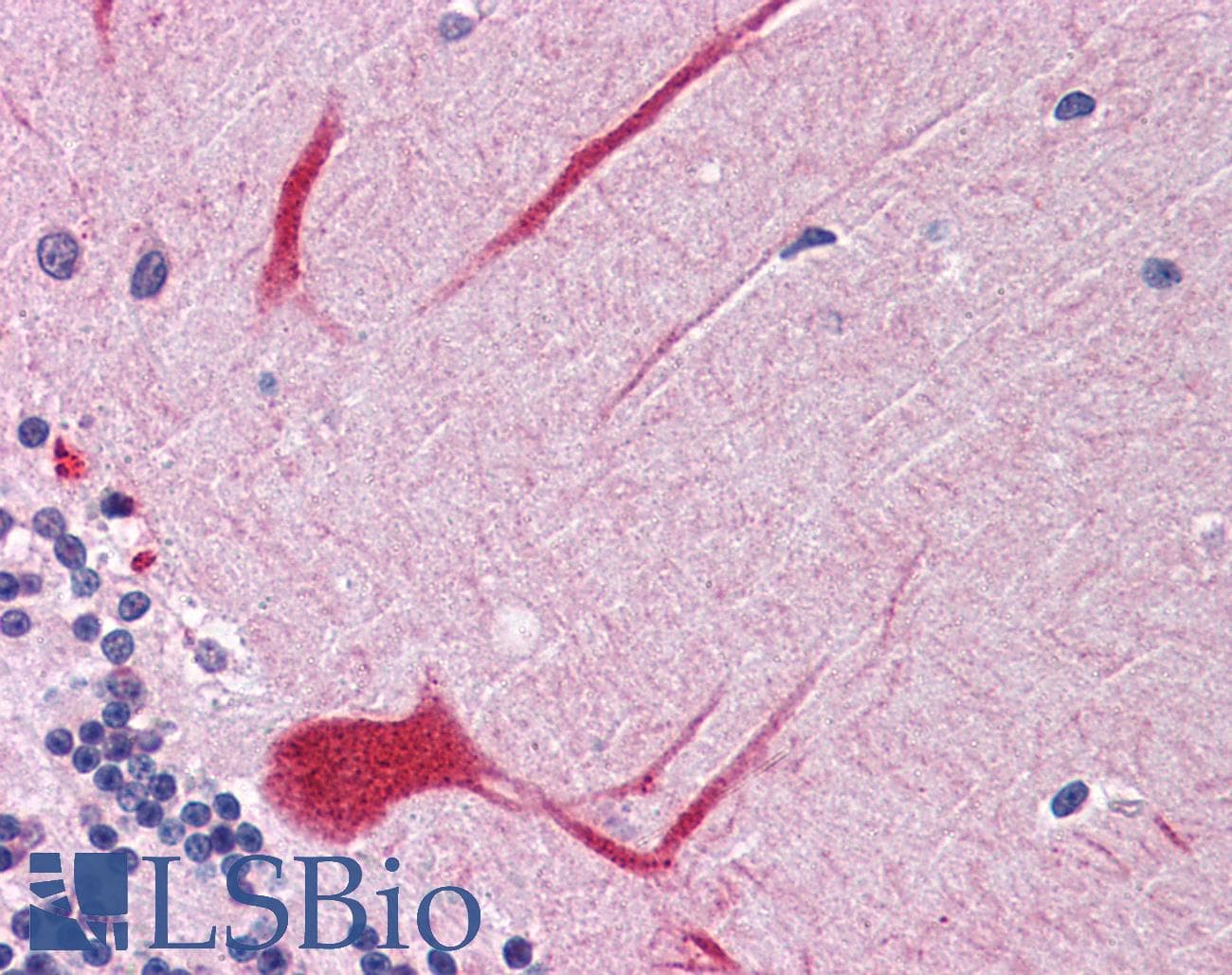 IHC-plus™ Polyclonal Goat anti-Human PTPN11 / SHP-2 / NS1 Antibody (aa584-597, IHC, IF, WB)