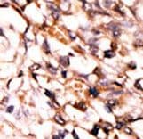 MAPKAPK5 / PRAK Antibody (phospho-Ser93)