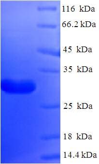 Human NANOS2 / NOS2 Protein (Recombinant His-SUMO)