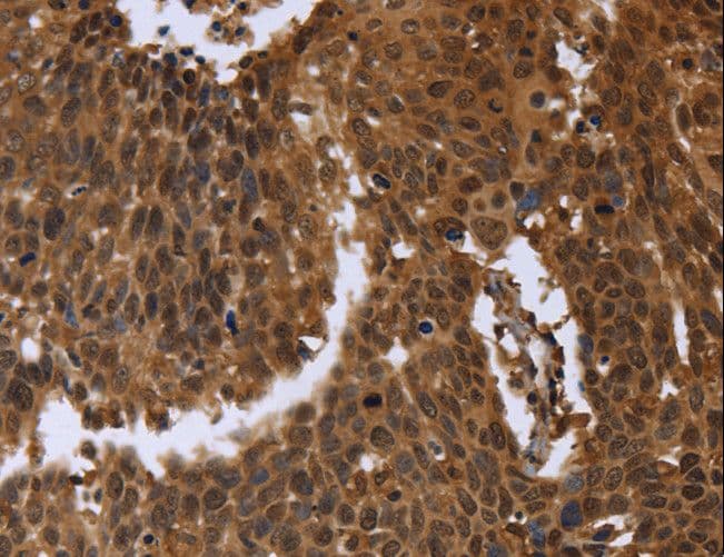 FGFRL1 Antibody