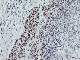 TP53 / p53 Antibody (clone OTI3A6)