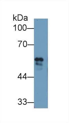 FGB / Fibrinogen Beta Chain Antibody (aa49-495, Biotin)