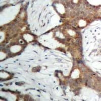 AR / Androgen Receptor Antibody (Internal)