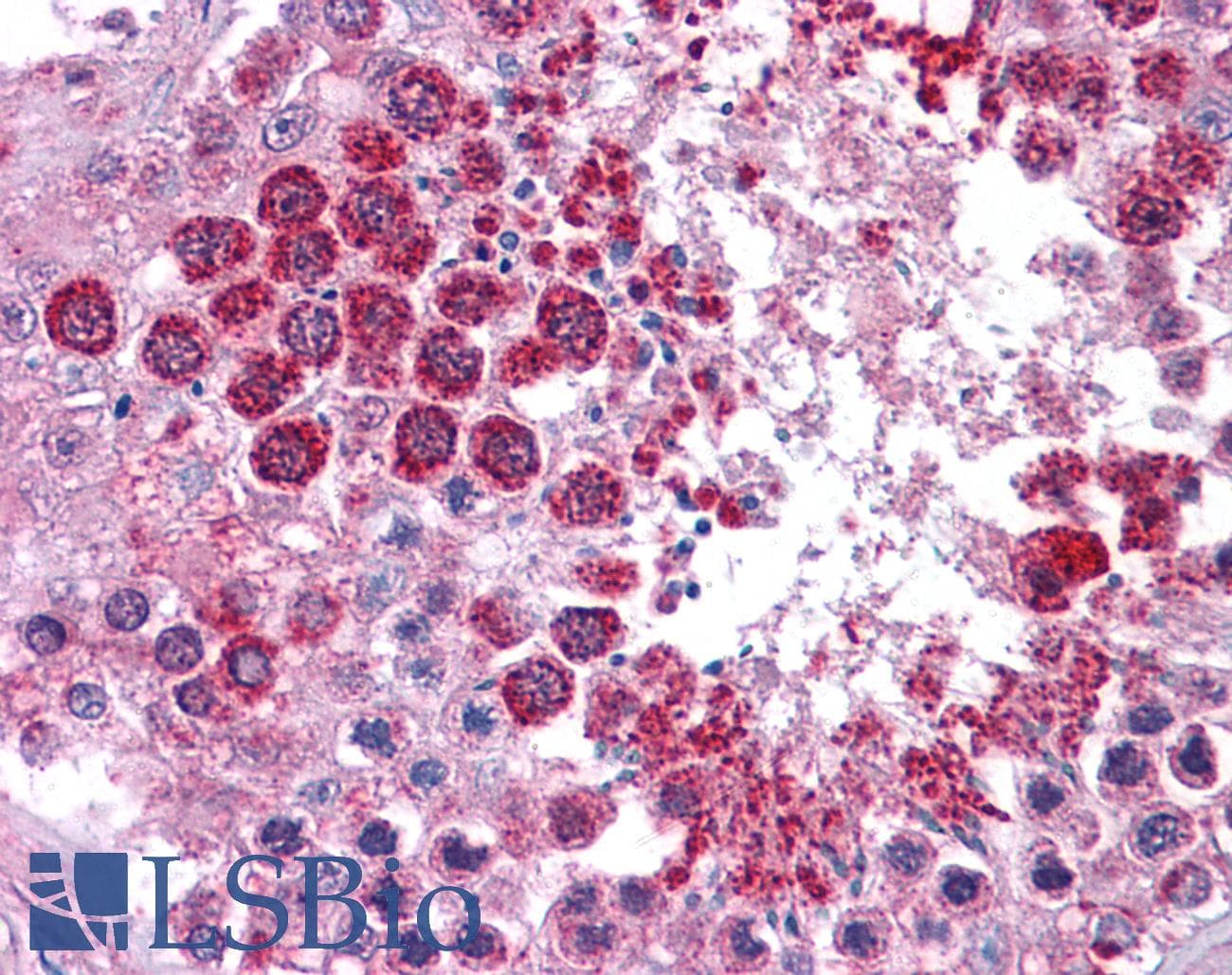 IHC-plus™ CRISP2 / TSP1 Antibody