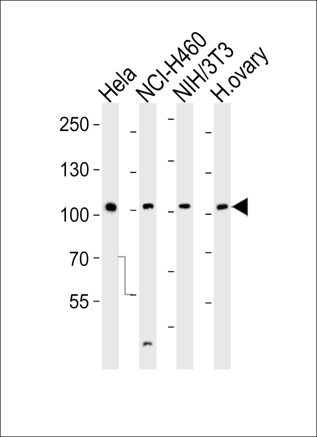 Polyclonal Rabbit anti-Human EPHA4 / EPH Receptor A4 Antibody (aa875-904, IHC, WB)