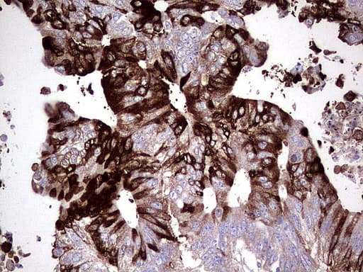 S100A9 / MRP14 Antibody (clone UMAB174, Carrier-free)