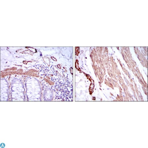 ACTA2 / Smooth Muscle Actin Antibody