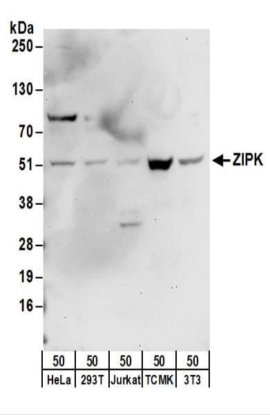 DAPK3 / ZIP Kinase Antibody (aa1-50)