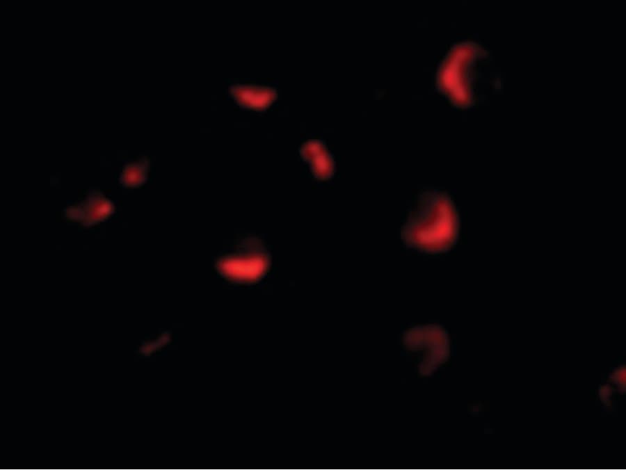IHC-plus™ MTA2 Antibody