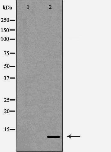 Polyclonal Rabbit anti-Human DBI / ACBD1 Antibody (IHC, WB)
