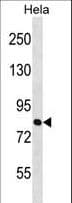 ZNF131 Antibody (aa205-233)