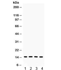 Polyclonal Rabbit anti-Human FABP4 / AP2 Antibody (IHC, WB)