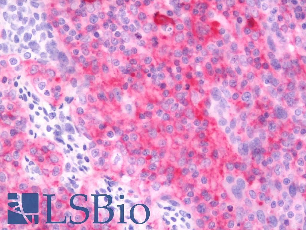 IHC-plus™ Monoclonal Mouse anti-Human CD40 Antibody (clone EA-5, Azide-free, IHC)