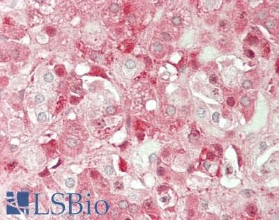 IHC-plus™ ST8SIA2 / STX Antibody