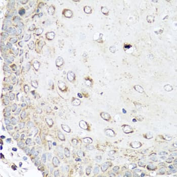 RAC2 Antibody