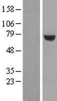 UTP6 Protein (Over-Expression Lysate Myc-DDK (Flag))