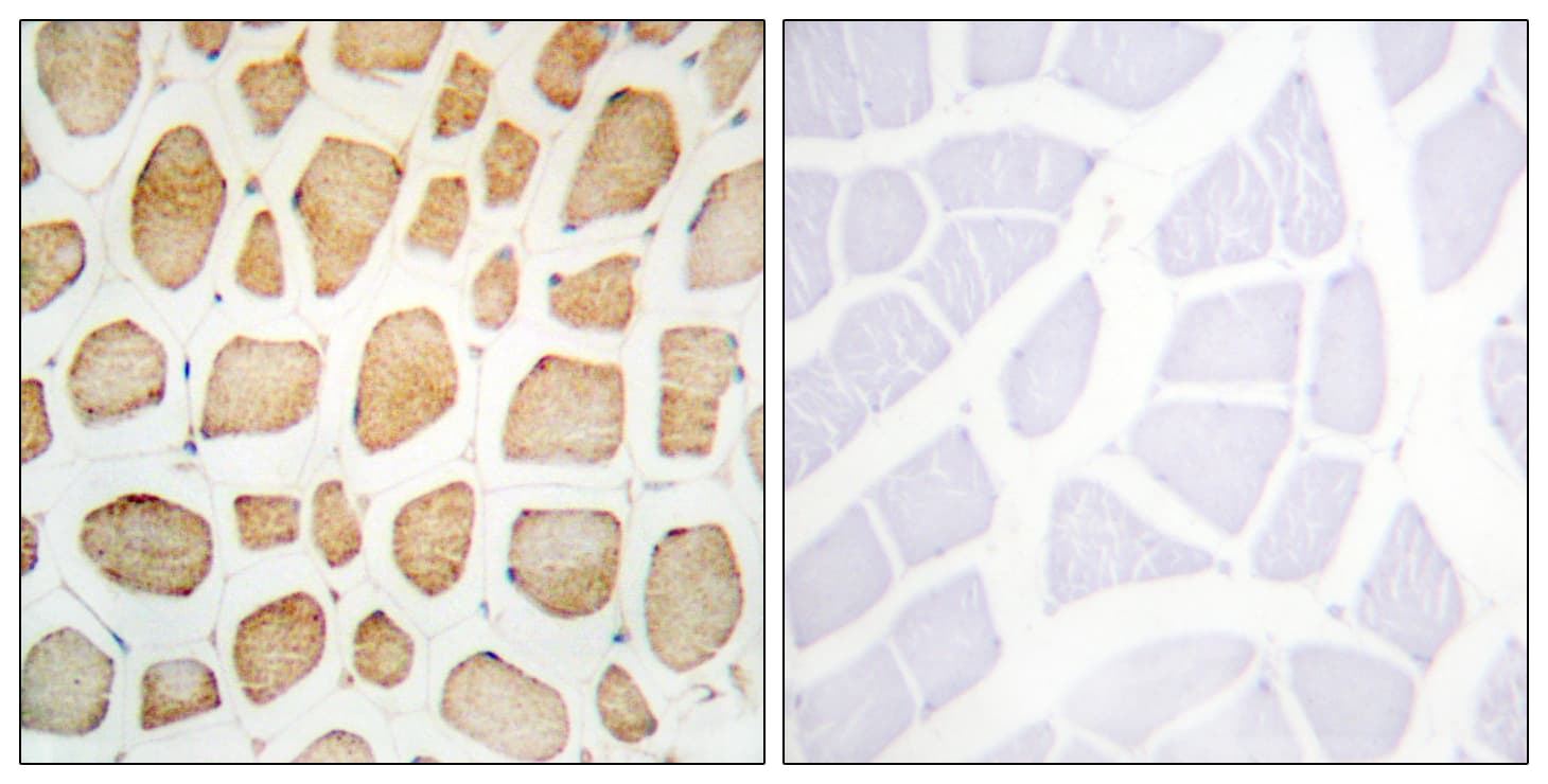 Polyclonal Rabbit anti-Human Actinin-Alpha 2+3 Antibody (N-Terminus, IHC, IF, WB)
