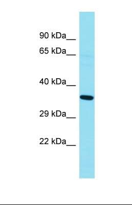 Polyclonal Rabbit anti-Human GKAP1 Antibody (aa22-71, WB)
