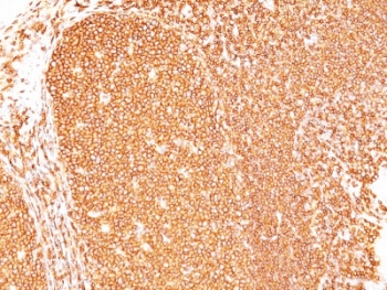 CD45 / LCA Antibody (clone Bra55)