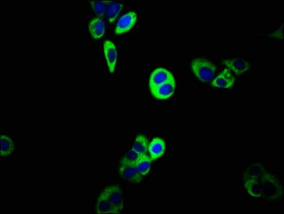 Polyclonal Rabbit anti-Human ABCC5 / MRP5 Antibody (IHC)