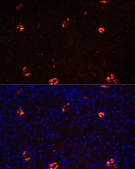 AQP2 / Aquaporin 2 Antibody