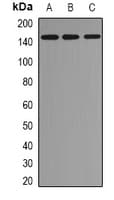 Polyclonal Rabbit anti-Human C11orf30 / EMSY Antibody (IF, WB)