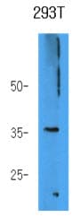 IHC-plus™ AKR7A3 Antibody (clone AT2E11)