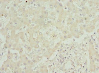 SAA1 / SAA / Serum Amyloid A Antibody