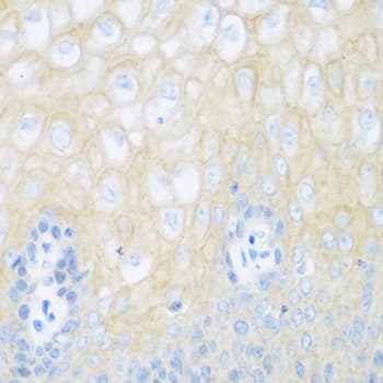 CDH1 / E Cadherin Antibody