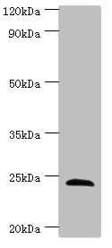 Polyclonal Rabbit anti-Human SOST / Sclerostin Antibody (aa24-213, IHC, WB)
