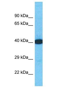 DTNA / Dystrobrevin Alpha Antibody (aa341-390)
