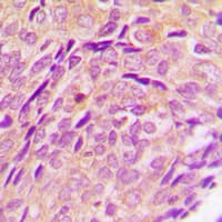 CYP2U1 Antibody (Internal)