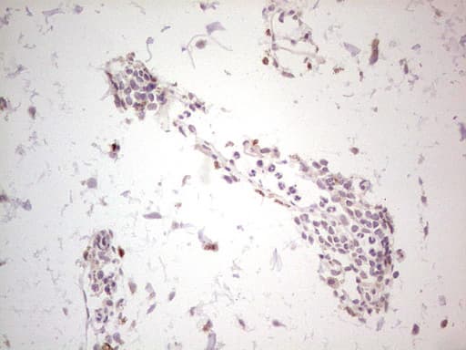 NEFM / NF-M Antibody (aa413-773, clone OTI5B7, Carrier-free)