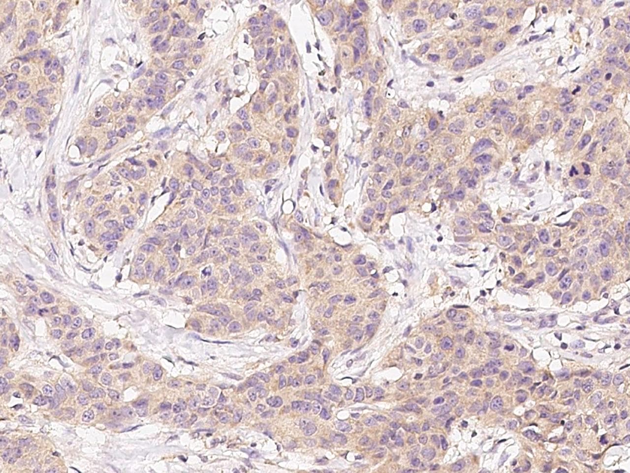 Polyclonal Rabbit anti-Human EPHA4 / EPH Receptor A4 Antibody (Preservative Free, IHC)