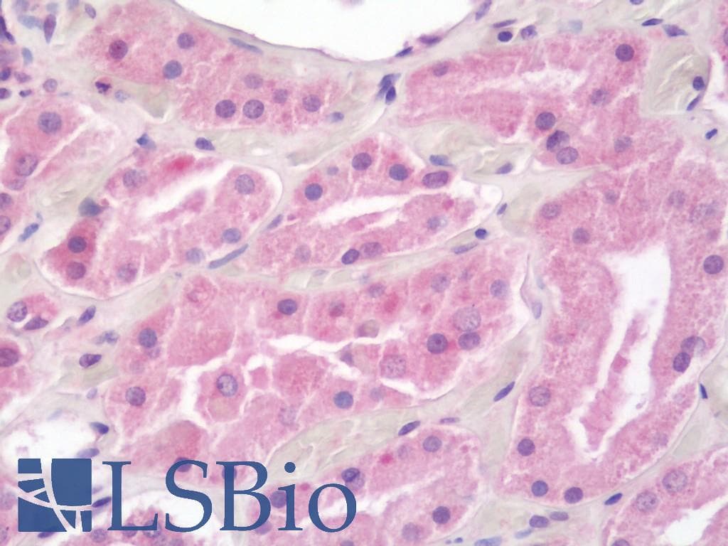IHC-plus™ AKT3 Antibody (clone 9H8)