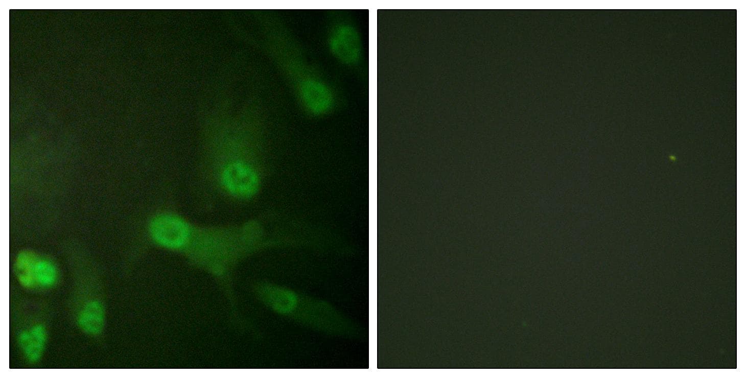 Polyclonal Rabbit anti-Human KIF11 / EG5 Antibody (phospho-Thr926, IHC, IF, WB)