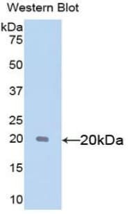 SHBG Antibody (aa222-358, Cy3)