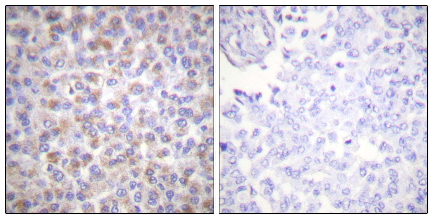 YWHAZ / 14-3-3 Zeta Antibody (p58)