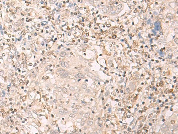 EPSTI1 Antibody