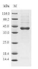 Human C19orf48 Protein (Recombinant GST, N-terminus)