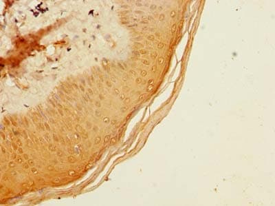 ADAT1 Antibody