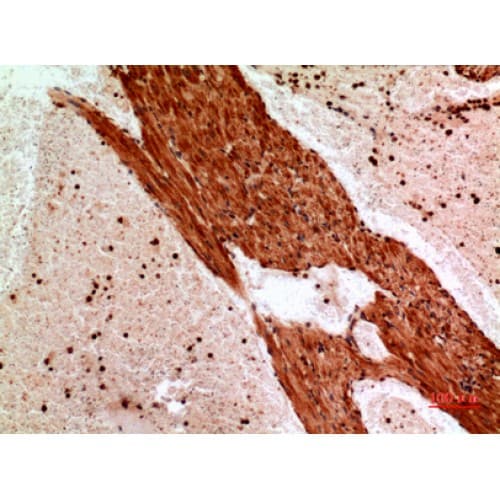 ANGPTL1 Antibody (1-50 aa, Internal)