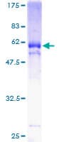 Human KLF6 Protein (Recombinant GST)