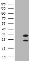 CD20 Antibody (clone OTI2D3, Carrier-free)