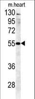 Polyclonal Rabbit anti-Human B4GALT5 Antibody (aa324-350, WB)