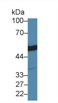 TUBB / Beta Tubulin Antibody (aa170-419)